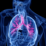 National Asthma Awareness Month: Enhancing Care with Expert Strategies and Telerespiratory Insights at rtNOW